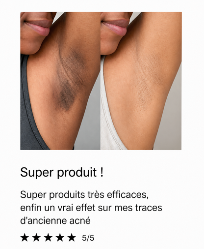 Savon biologique anti-tâches au Curcuma & Acide Kojic