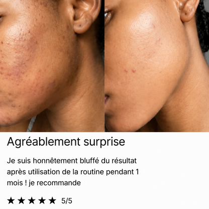 Savon bio anti-tâches au Curcuma & Acide Kojic