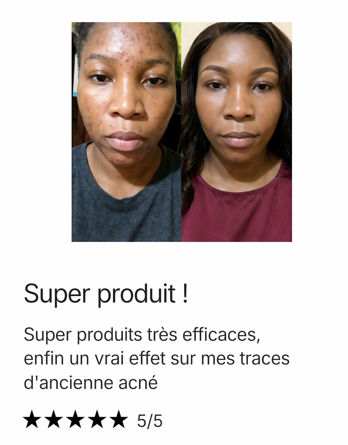 Savon biologique anti-tâches au Curcuma & Acide Kojic