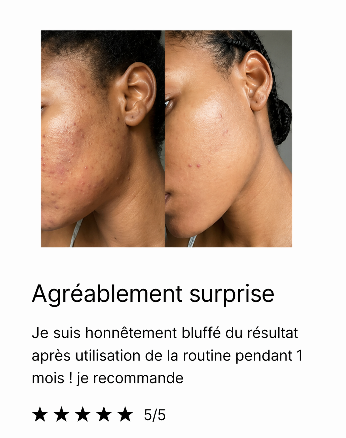 Savon biologique anti-tâches au Curcuma & Acide Kojic