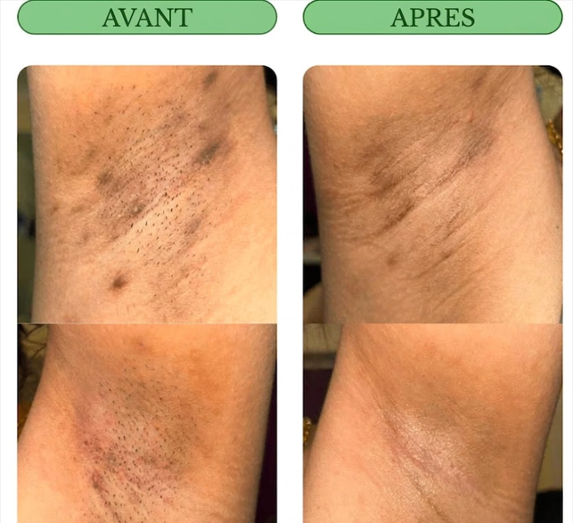 Savon biologique anti-tâches au Curcuma & Acide Kojic