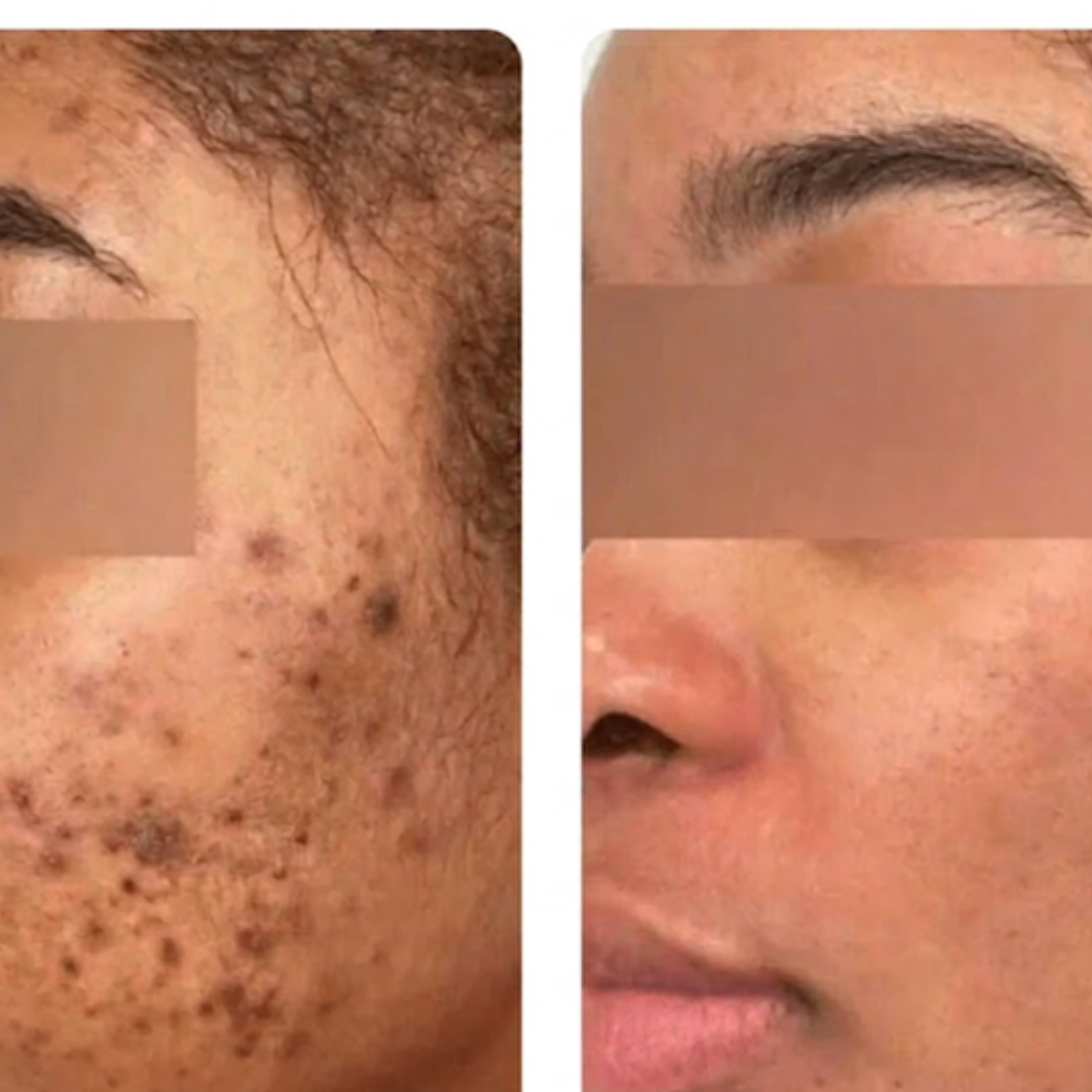 Savon bio anti-tâches au Curcuma & Acide Kojic