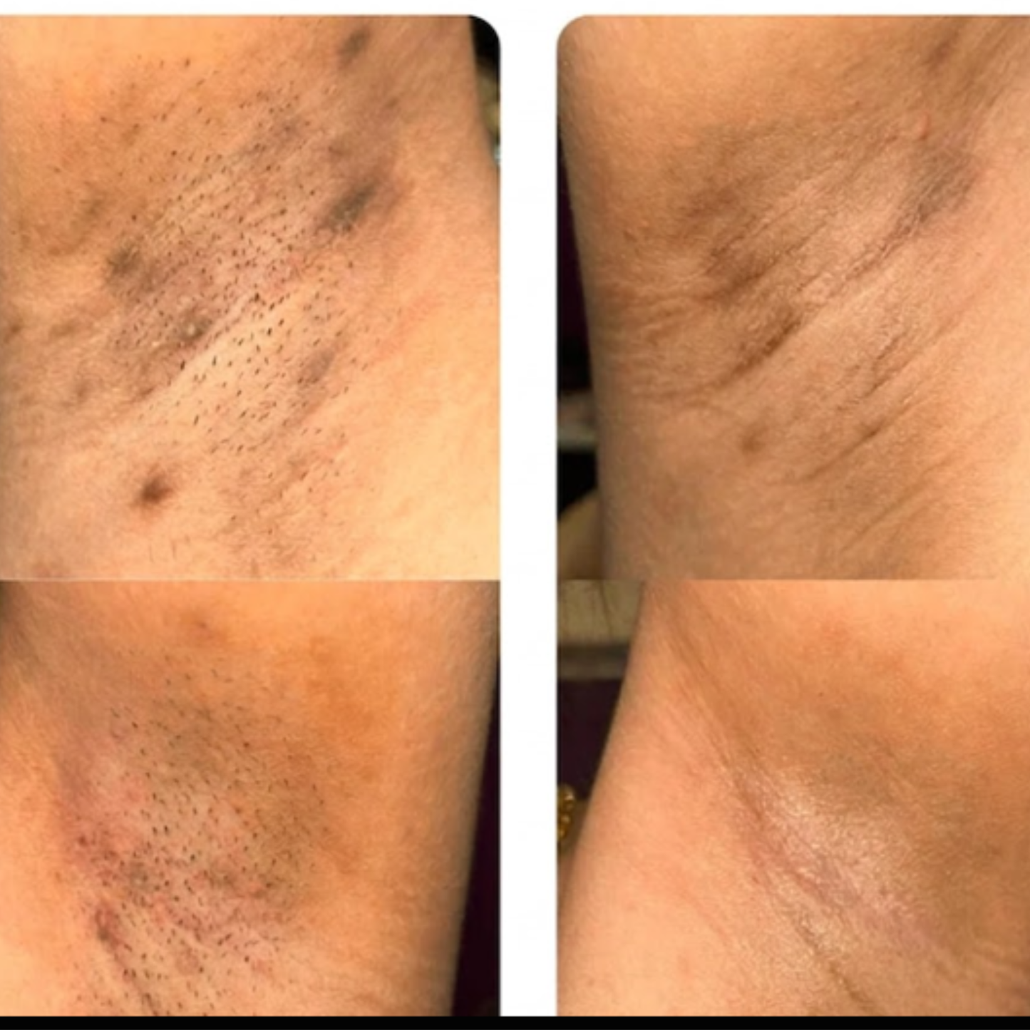 Savon bio anti-tâches au Curcuma & Acide Kojic