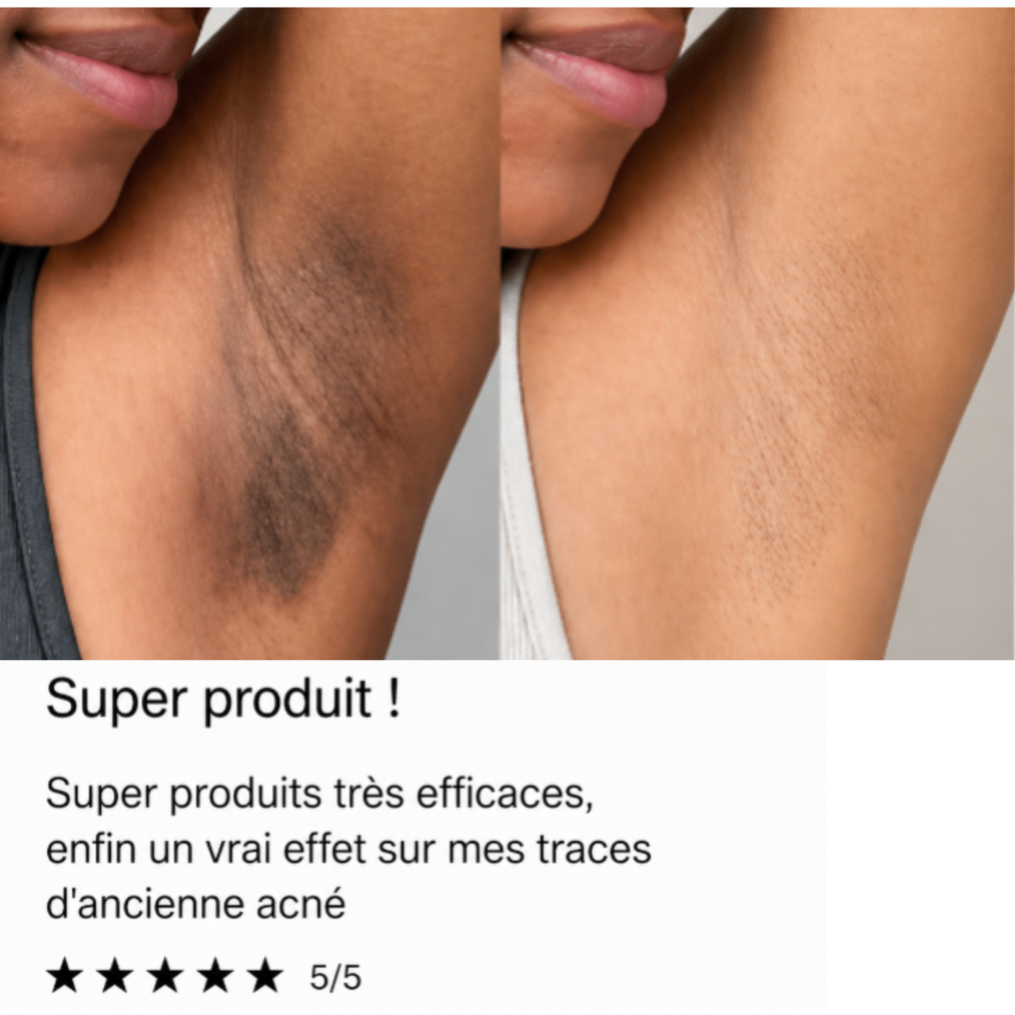 Savon bio anti-tâches au Curcuma & Acide Kojic