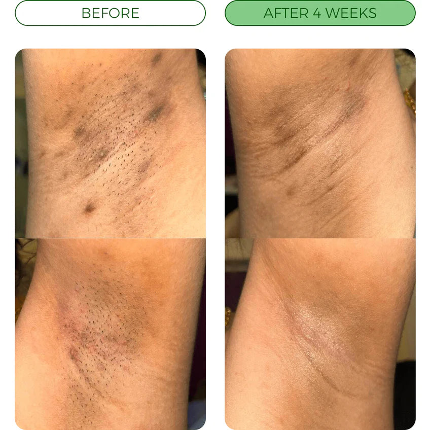 Savon anti-tâches au Curcuma & Acide Kojic